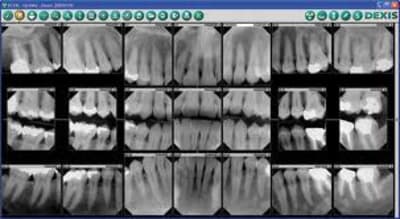 X ray t3ykgl - Eugenol