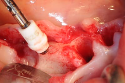 Xiqp5fkhcqighrhnwwl5 - Eugenol