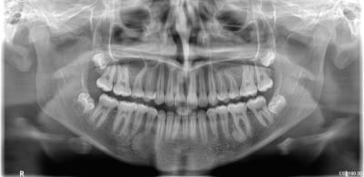 Xpzudwp2c4pscwdiqbdjqw7h9v80 - Eugenol