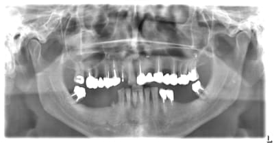 Xxx ti2zxa - Eugenol