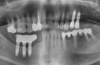 Xyjgsxtrr671b2abggyy - Eugenol
