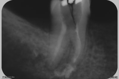 Yamen ilcmna - Eugenol