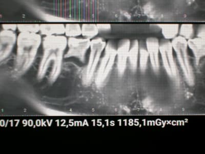 Yfp0ocilneumxulmy8ot - Eugenol