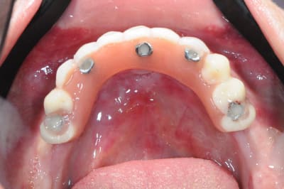 Zf6kw3d8fqwhqrcwucgy - Eugenol