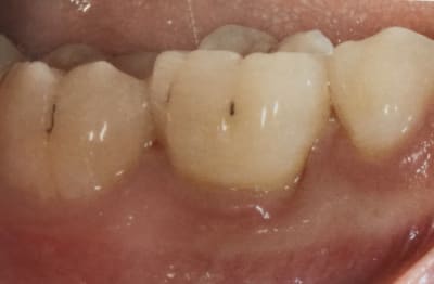 Zwjdcxonyn8e26gnxgsc - Eugenol