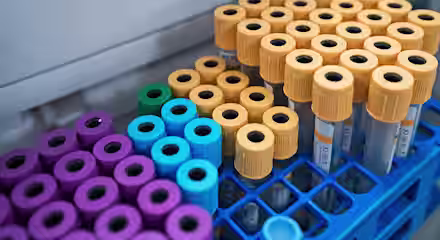 Close-up of racks holding multiple blood collection tubes with yellow, blue, and purple caps, organized in a laboratory setting, ready for testing or analysis.