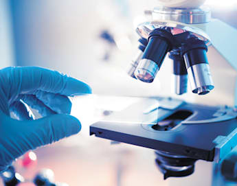 A close-up image shows a person wearing blue gloves positioning a glass slide under the lenses of a microscope in a laboratory setting. The scene is brightly lit, and the microscope's intricate details are in sharp focus, highlighting scientific research.