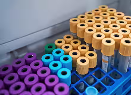 Close-up of racks holding multiple blood collection tubes with yellow, blue, and purple caps, organized in a laboratory setting, ready for testing or analysis.