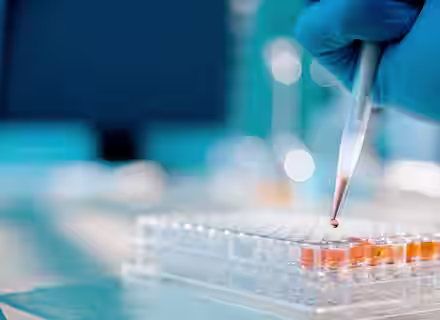 A gloved hand uses a pipette to dispense liquid into a well plate in a laboratory setting. The image focuses on the pipette tip and the well plate, with blurred scientific equipment in the background, emphasizing laboratory research activities.
