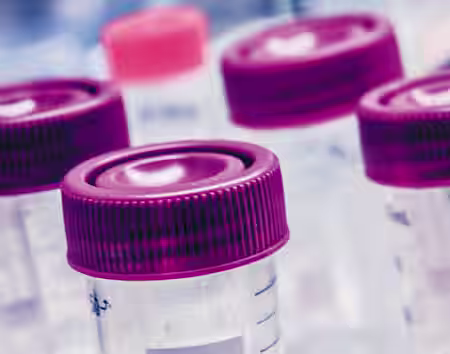 Close-up of several clear plastic laboratory containers with dark red screw caps. The containers are positioned upright and have measurement markings, indicating they are likely used for scientific experiments or sample storage. The background is blurred.