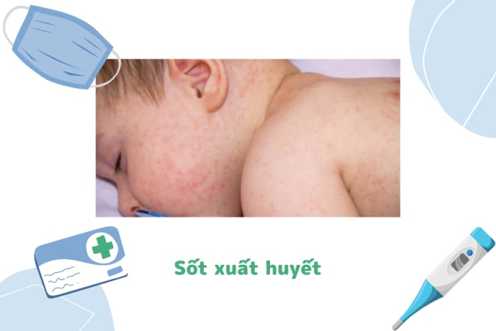 CÁC LOẠI SỐT THƯỜNG GẶP Ở TRẺ VÀ HƯỚNG DẪN CÁCH HẠ SỐT NHANH