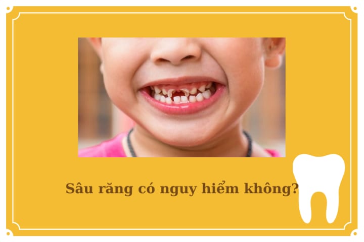 DẤU HIỆU CON BỊ SÂU RĂNG? NHỮNG THÓI QUEN GÂY HẠI CHO RĂNG CỦA CON