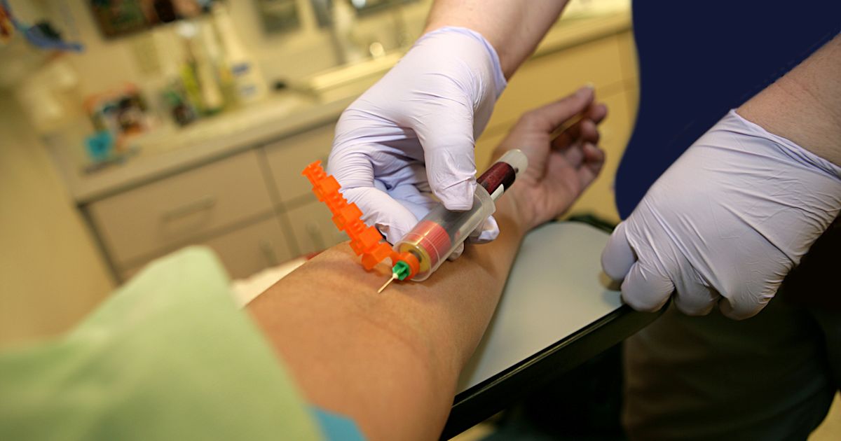 Managing HIV While Also Managing Hep C Sharecare