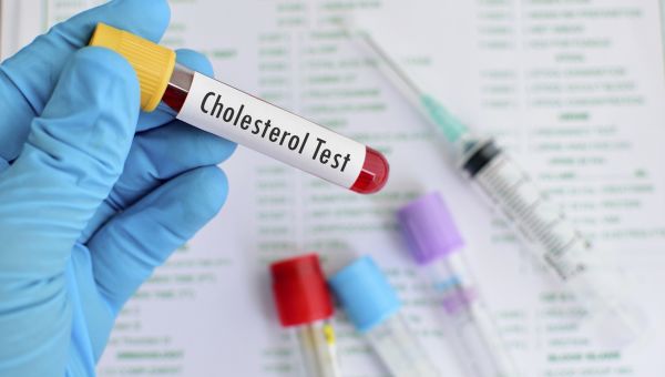 cholesterol test