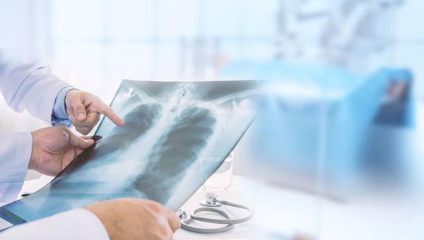 Doctor examining x-ray of a patient's lungs