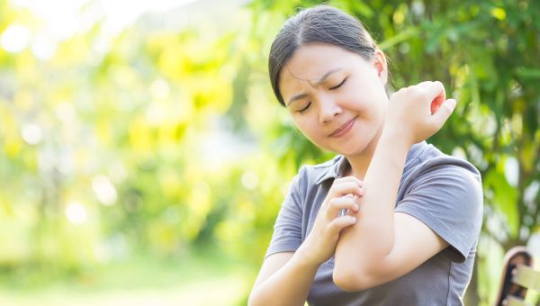 woman itching her arm