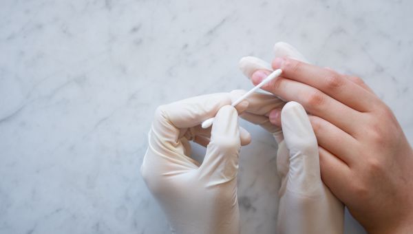 doctor treating wart on finger
