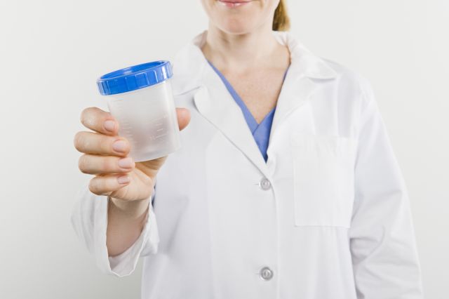 A lab worker holds a specimen cup ready to check for healthy pee color and odor. She is hoping not to see dark urine.