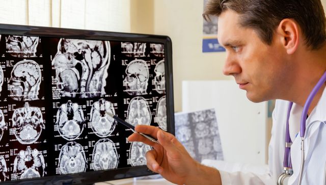 doctor looking at mri images of brain scans