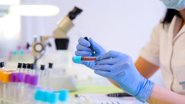 woman working in a laboratory, blood test, blood sample, blood test for rheumatoid arthritis