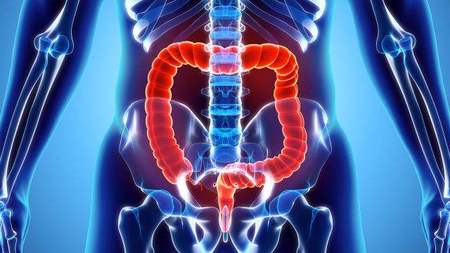 x ray of the intestines