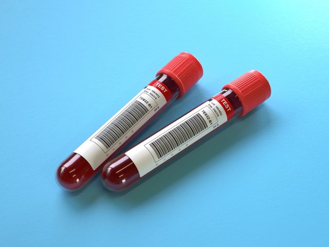 Blood samples in test tubes on a white background.