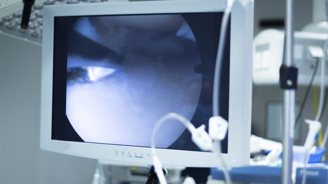 Video monitor during arthroscopic surgery.