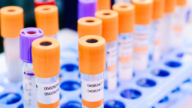Blood vials for hep C testing.