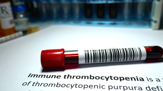 Full blood sample vial laying on a table waiting to be tested for immune thrombocytopenia (ITP).