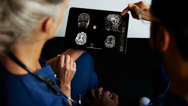 Two oncologists consult about the results of an imaging test showing a brain tumor.