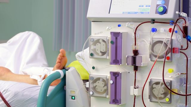 A person with end-stage kidney disease receives hemodialysis in a hospital setting.