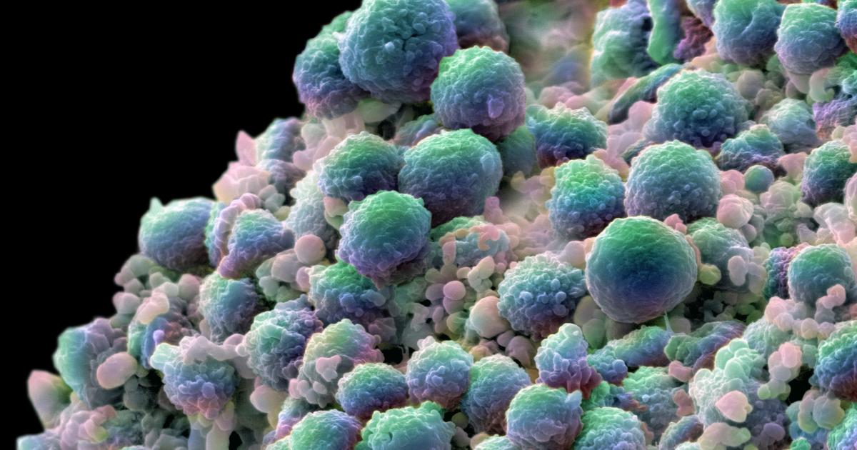 Gearing Up Against Skin Cancer Pursuit By The University Of