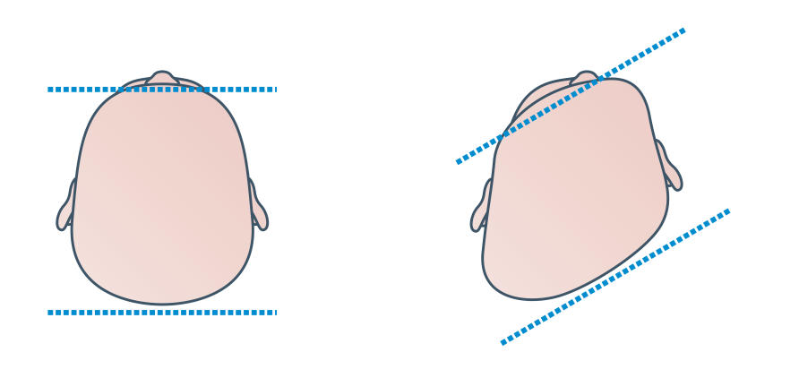 avoid flat head