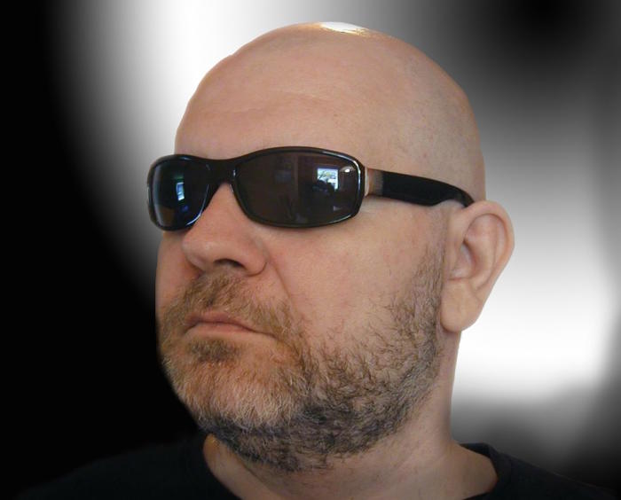 Are there more bald men than women? | Pursuit by The University of Melbourne Are there more bald men than women? | Pursuit by The University of Melbourne