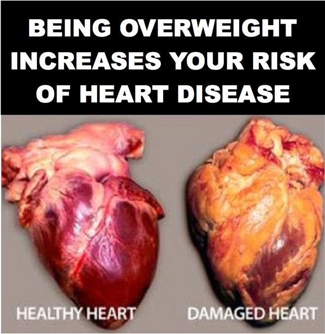 Would graphic warnings on unhealthy food make you think again ...