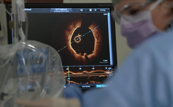 The interventional cardiology team at St Vincent’s Hospital, Melbourne, monitor a super high resolution image of the interior of a patient’s arteries, captured using the tiny optical coherence tomography (OCT) camera. Picture: Paul Burston